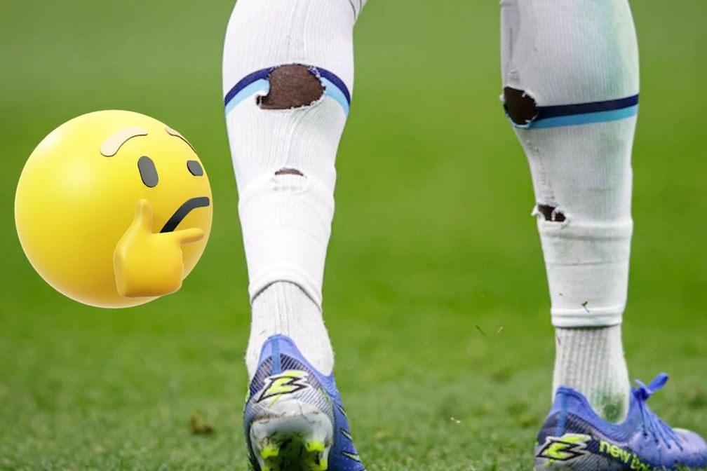 Deshalb haben viele Fussballspieler Löcher in den Stulpen