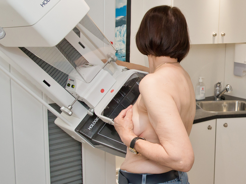 Baselbieter Landrat befürwortet Mammografie-Screening-Programm