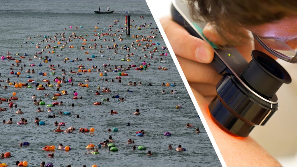 Am Rheinschwimmen kannst du gratis dein Muttermal zeigen