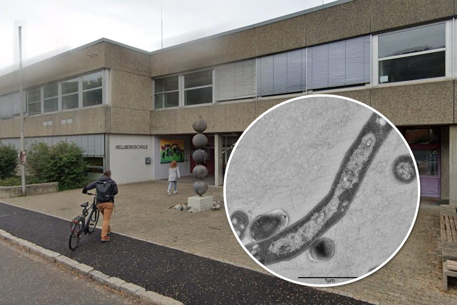 Tuberkulose-Fall an Schule in Lörrach bestätigt