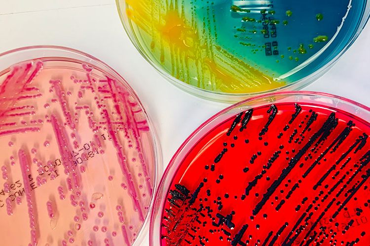 Basler Forschungsteam entdeckt 35 neue Bakterien