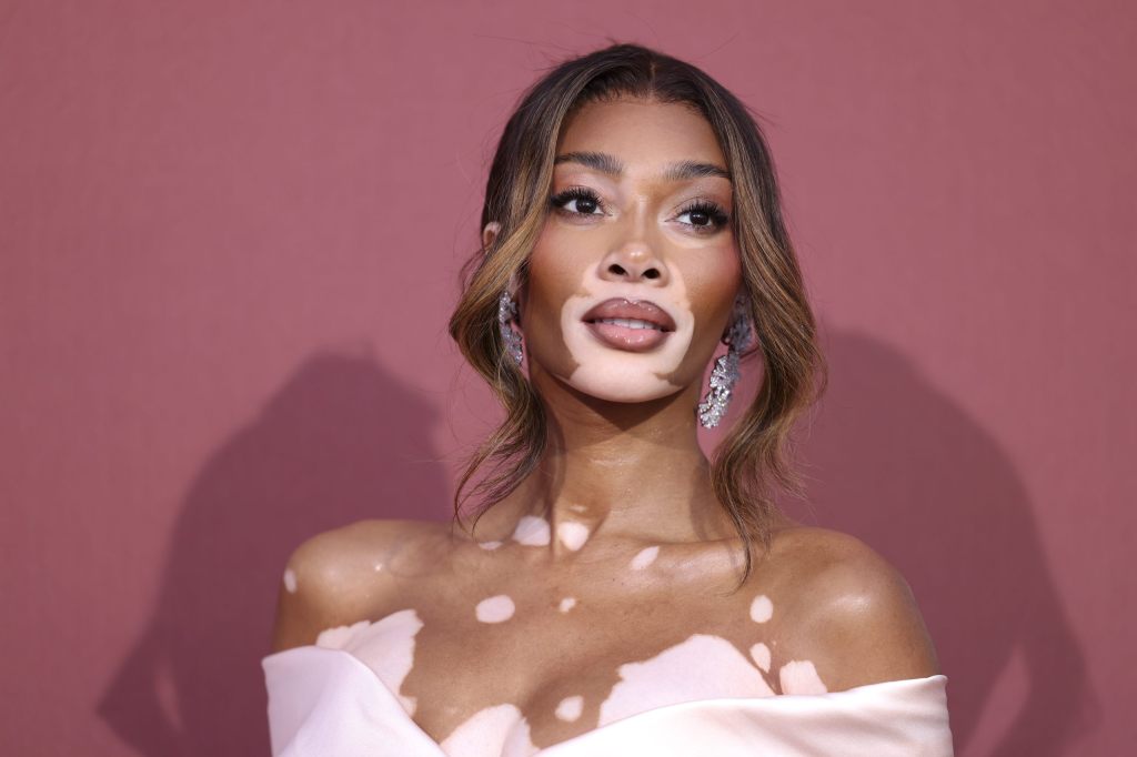 Heute ist Welt-Vitiligo-Tag
