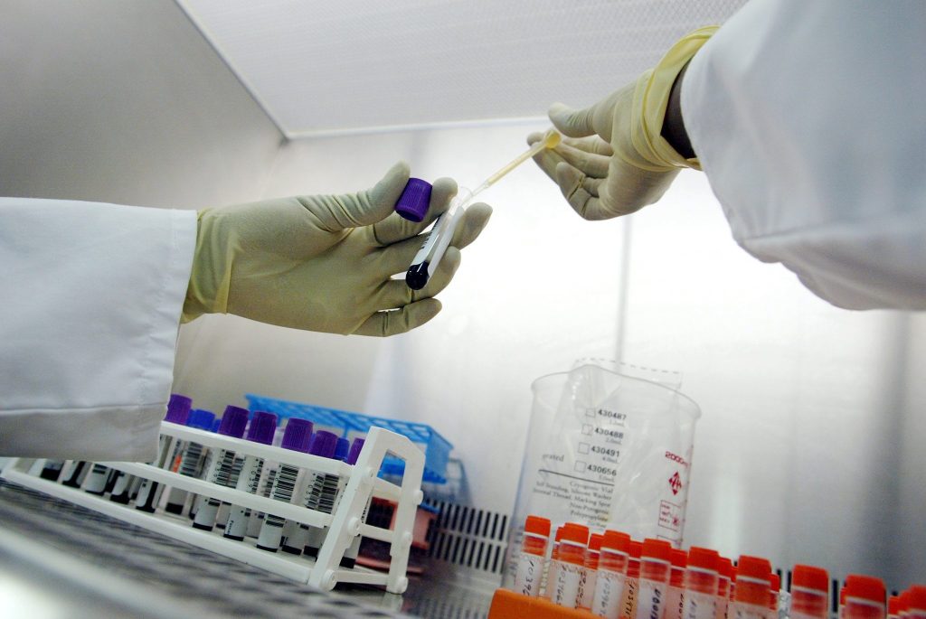 Fortschritte im Kampf gegen Aids und HIV stagnieren