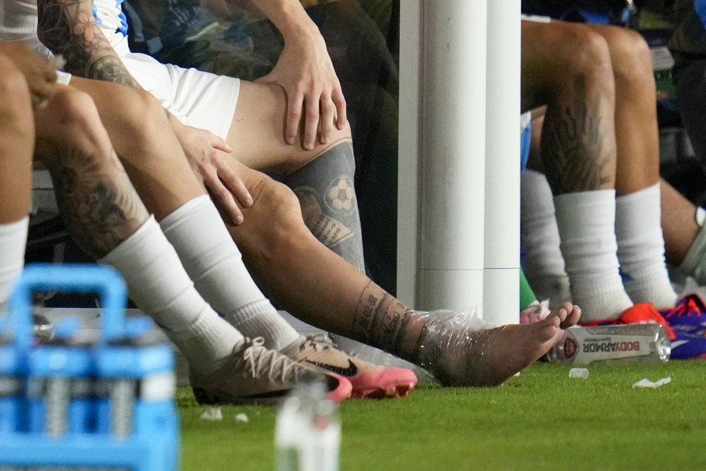 Messi fällt mit Bänderverletzung für unbestimmte Zeit aus