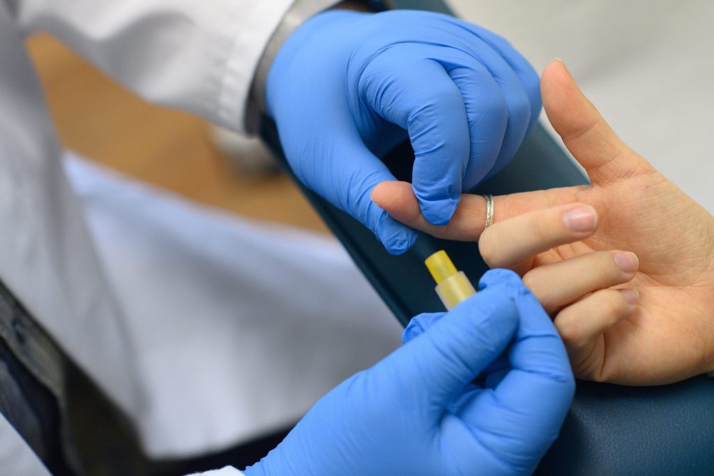 Zweiter HIV-Patient in Berlin geheilt