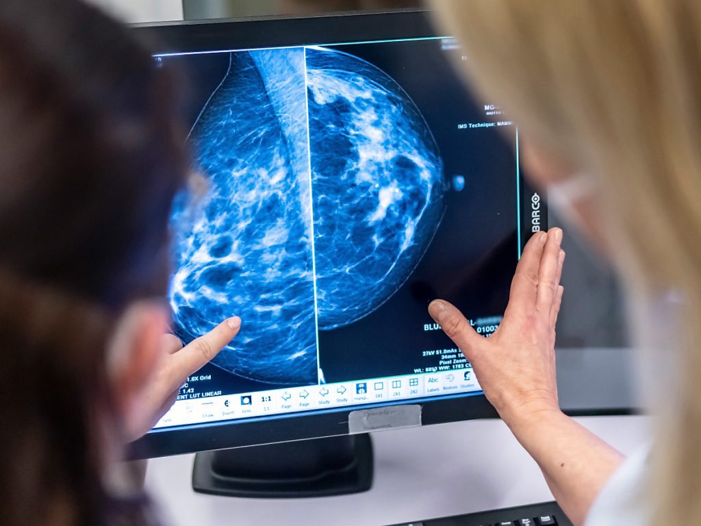 Frauen in Baselland können bald alle zwei Jahre zum Brustkrebs-Check
