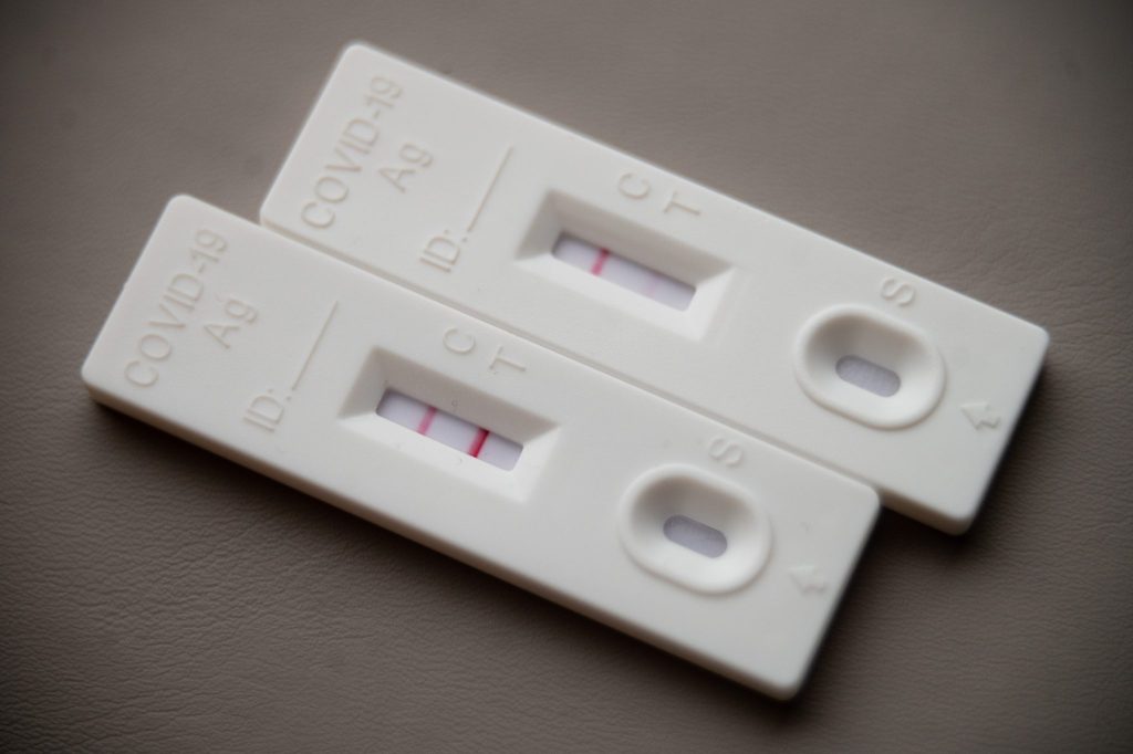 Covid-Infektion könnte Blutgefässe schneller altern lassen