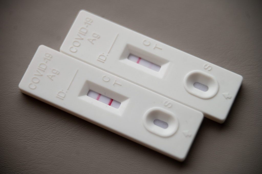 Covid-Infektion könnte Blutgefässe schneller altern lassen