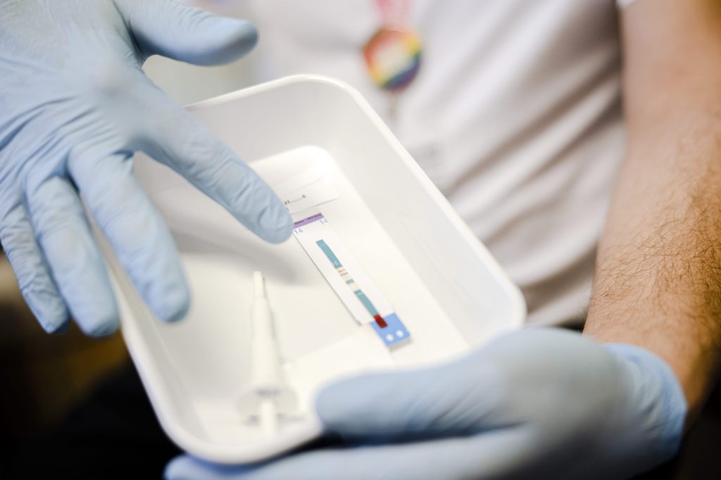 HIV-Fallzahlen in der Schweiz sinken weiter