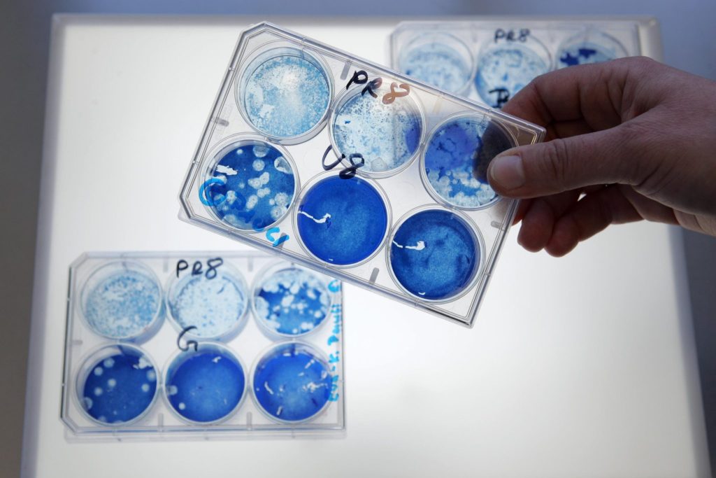 US-Behörde meldet Vogelgrippe-Fall bei einem Menschen