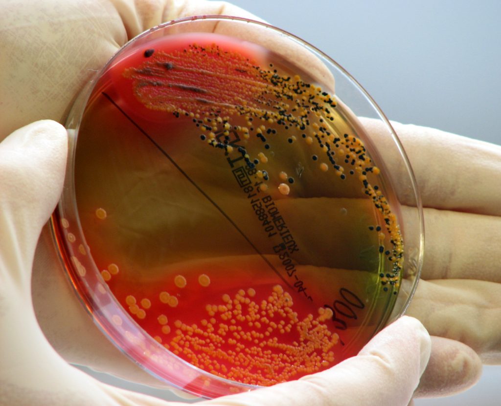 Tod von Deutschen in Istanbul stellt Ermittler vor Rätsel