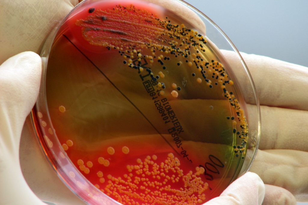 Tod von Deutschen in Istanbul stellt Ermittler vor Rätsel